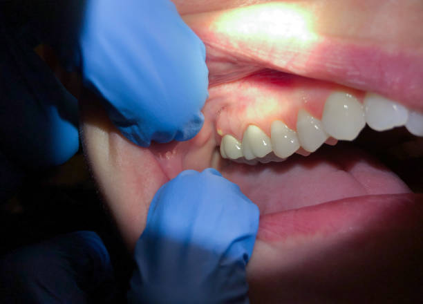 Best Pediatric Emergency Dentist in Venetian Vlage, IL