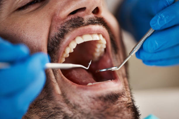 Best Emergency Root Canal Treatment in Venetian Vlage, IL